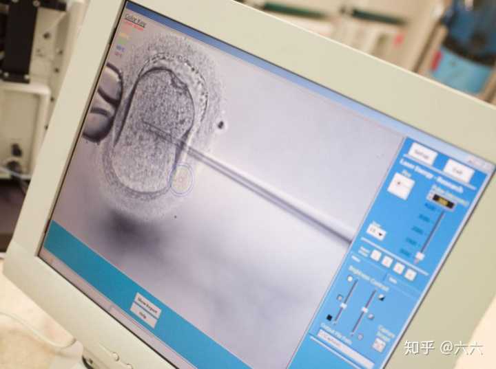 河南省长沙市人民医院做试管婴儿可以选性别吗